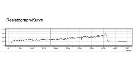 Resistographkurve